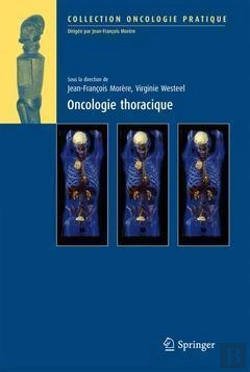 Bertrand.pt - Oncologie Thoracique
