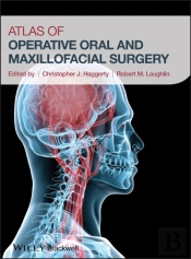 Operative Atlas Of Oral And Maxillofacial Surgery