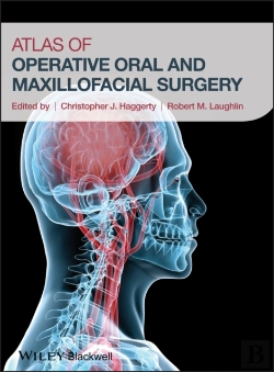 Bertrand.pt - Operative Atlas Of Oral And Maxillofacial Surgery