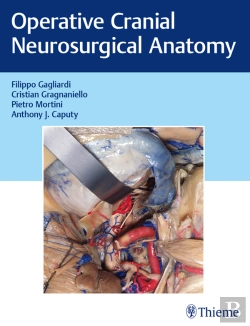 Bertrand.pt - Operative Cranial Neurosurgical Anatomy