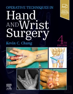Bertrand.pt - Operative Techniques: Hand And Wrist Surgery