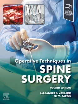Bertrand.pt - Operative Techniques: Spine Surgery E-Book