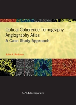 Bertrand.pt - Optical Coherence Tomography Angiography Atlas