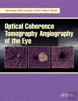 Bertrand.pt - Optical Coherence Tomography Angiography Of The Eye