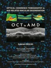 Optical Coherence Tomography In Age-Related Macular Degeneration