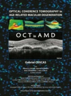 Bertrand.pt - Optical Coherence Tomography In Age-Related Macular Degeneration