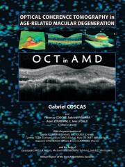 Optical Coherence Tomography In Age-Related Macular Degeneration