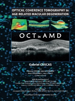 Bertrand.pt - Optical Coherence Tomography In Age-Related Macular Degeneration
