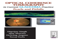 Optical Coherence Tomography In Current Glaucoma Practice