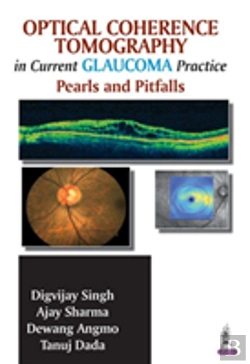 Bertrand.pt - Optical Coherence Tomography In Current Glaucoma Practice