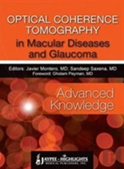 Optical Coherence Tomography In Macular Diseases And Glaucoma: Advanced Knowledge