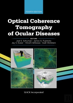 Bertrand.pt - Optical Coherence Tomography Of Ocular Diseases