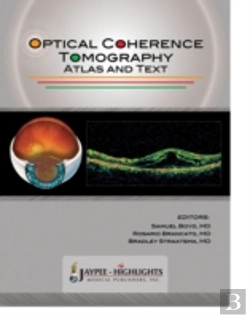 Bertrand.pt - Optical Coherence Tomography