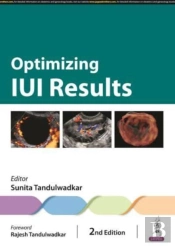 Optimizing Iui Results