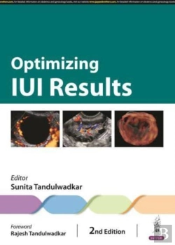 Bertrand.pt - Optimizing Iui Results