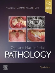 Oral And Maxillofacial Pathology - E-Book