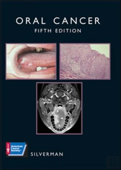 Bertrand.pt - Oral Cancer