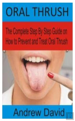 Bertrand.pt - Oral Thrush