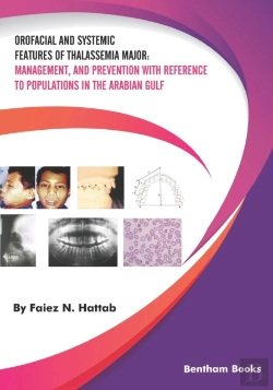 Bertrand.pt - Orofacial And Systemic Features Of Thalassemia Major