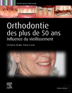 Bertrand.pt - Orthodontie Des Plus De 50 Ans
