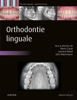 Bertrand.pt - Orthodontie Linguale