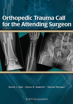 Bertrand.pt - Orthopedic Trauma Call For The Attending Surgeon
