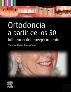 Bertrand.pt - Ortodoncia A Partir De Los 50