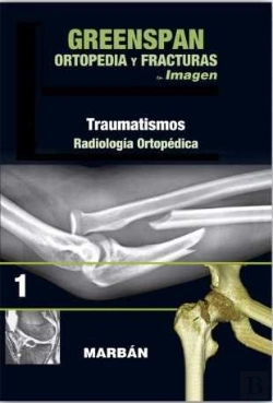 Bertrand.pt - Ortopiedia Y Fracturas Vol.1