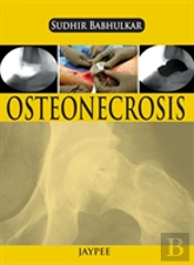 Osteonecrosis
