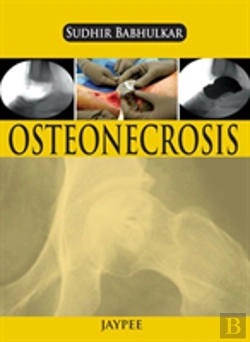 Bertrand.pt - Osteonecrosis