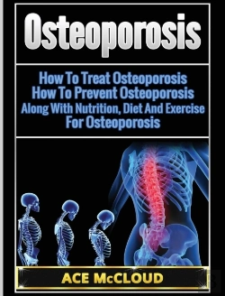 Bertrand.pt - Osteoporosis