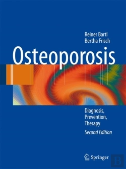 Bertrand.pt - Osteoporosis