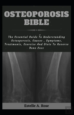 Bertrand.pt - Osteoporosis Bible