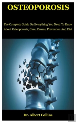 Bertrand.pt - Osteoporosis