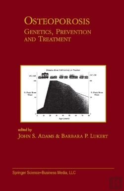 Bertrand.pt - Osteoporosis: Genetics, Prevention And Treatment