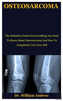 Bertrand.pt - Osteosarcoma