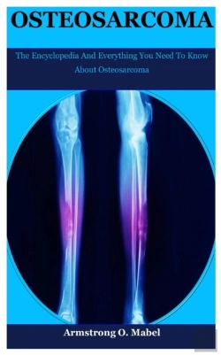 Bertrand.pt - Osteosarcoma