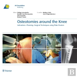 Bertrand.pt - Osteotomies Around The Knee