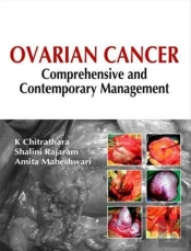Ovarian Cancer Comprehensive Contempora