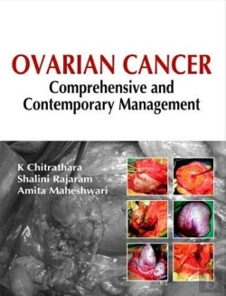 Bertrand.pt - Ovarian Cancer Comprehensive Contempora