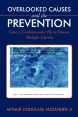 Bertrand.pt - Overlooked Causes And The Prevention: Ca