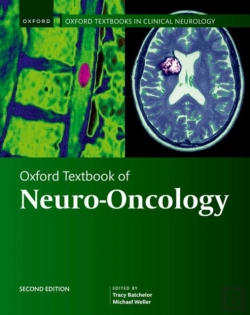 Bertrand.pt - Oxford Textbook Of Neuro-Oncology