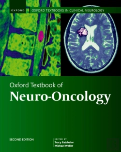 Bertrand.pt - Oxford Textbook Of Neuro-Oncology