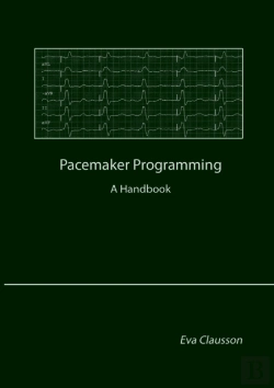 Bertrand.pt - Pacemaker Programming