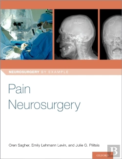 Bertrand.pt - Pain Neurosurgery