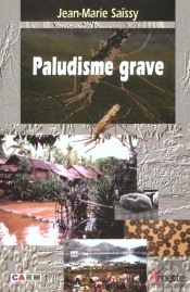 Paludisme Grave