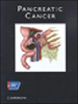 Bertrand.pt - Pancreatic Cancerpancreatic Cancer
