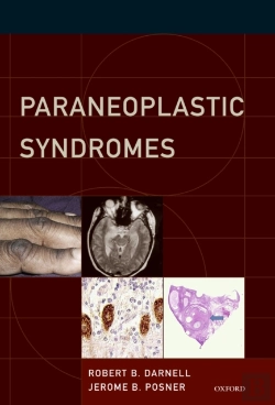 Bertrand.pt - Paraneoplastic Syndromes