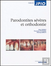 Parodontités Sévères Et Orthodontie
