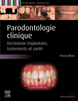 Bertrand.pt - Parodontologie Clinique : Dentisterie Implantaire, Traitements Et Santé